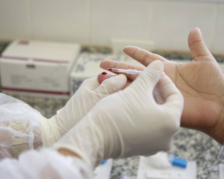 Saiba onde fazer exame ou buscar atendimento para Infecções Sexualmente Transmissíveis no SUS